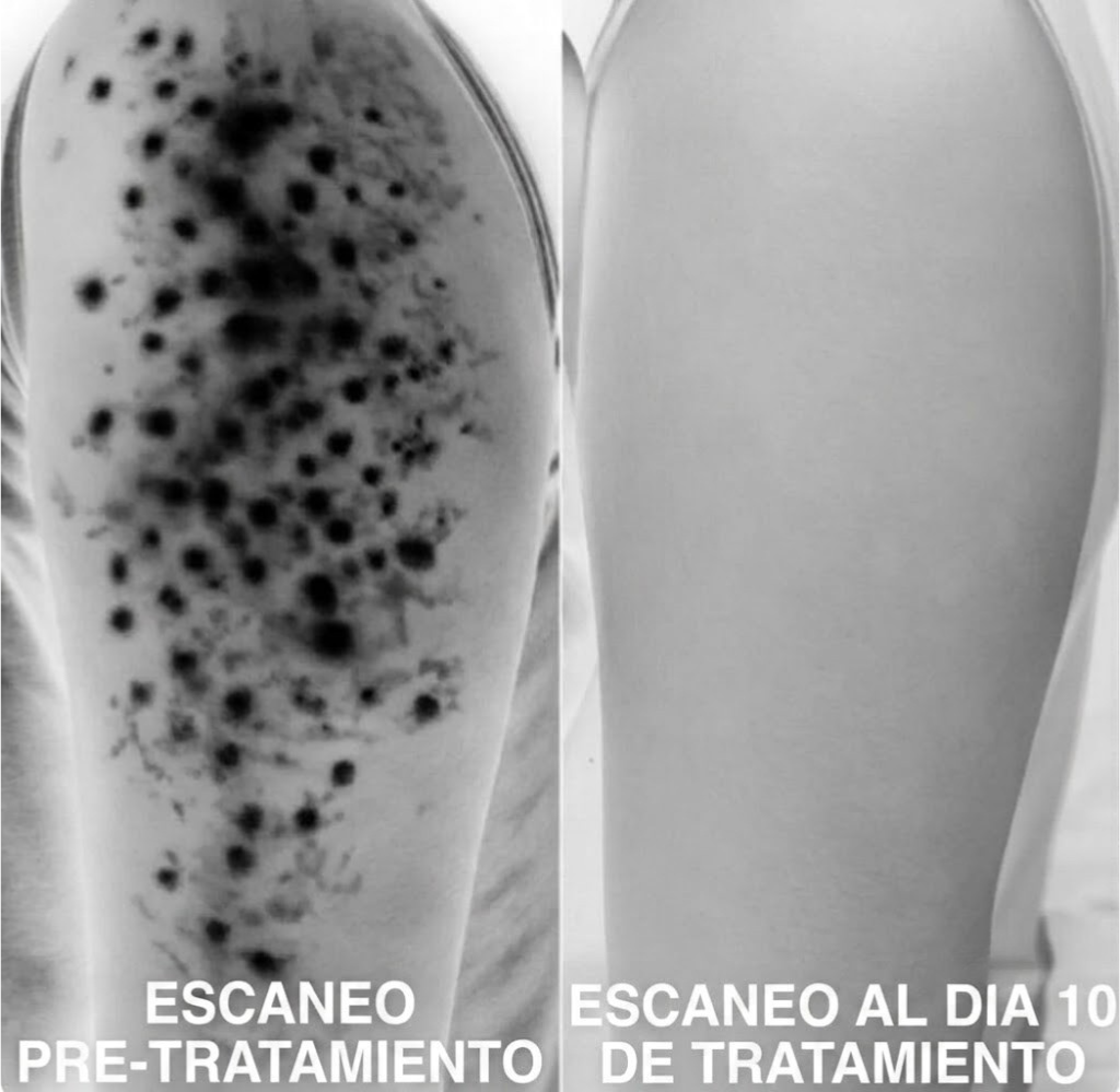 WhiteMoon® Strawberry Skin — KERA Crema Rejuvenecedora Triple Ácido