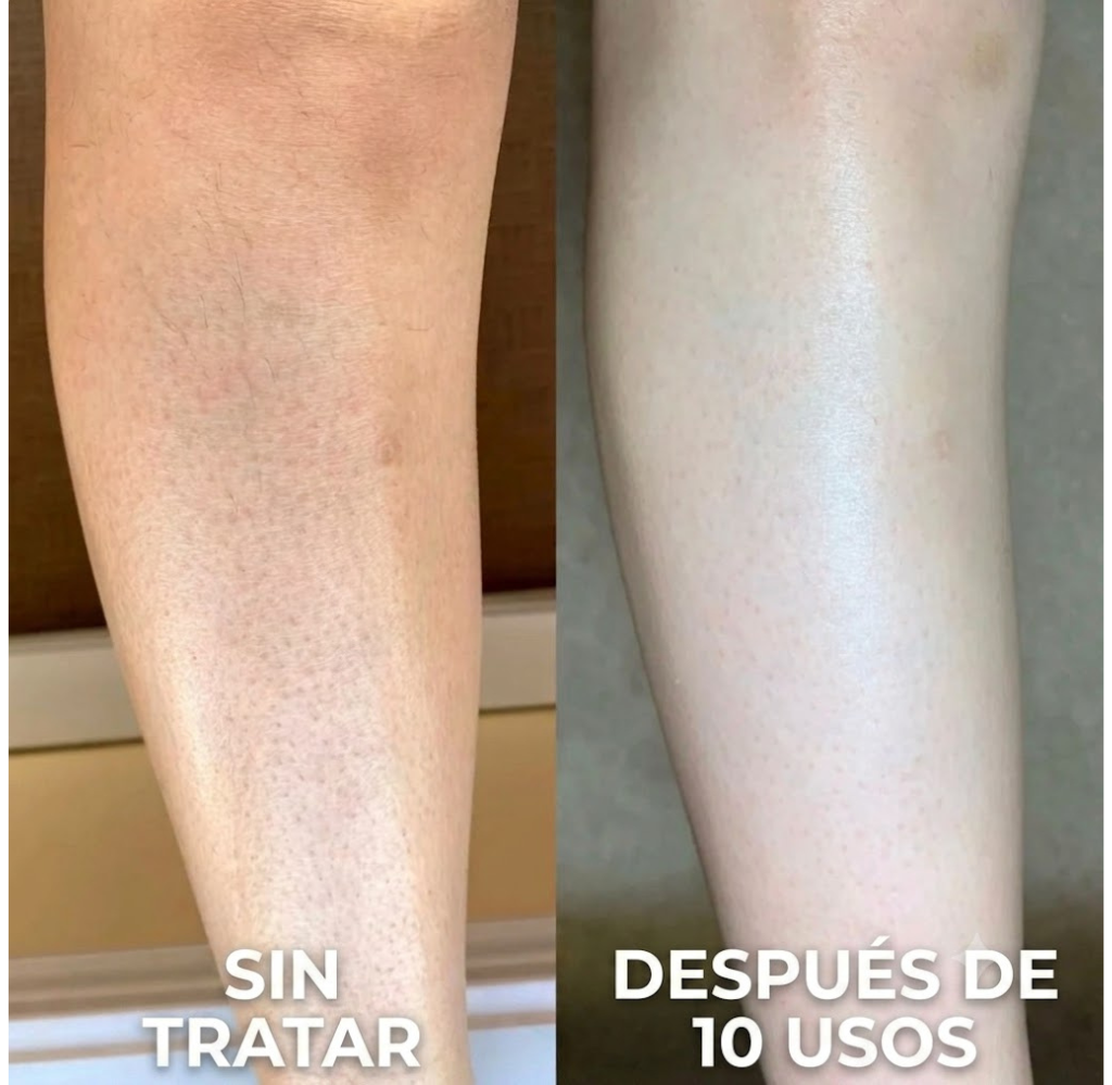 WhiteMoon® Strawberry Skin — KERA Crema Rejuvenecedora Triple Ácido