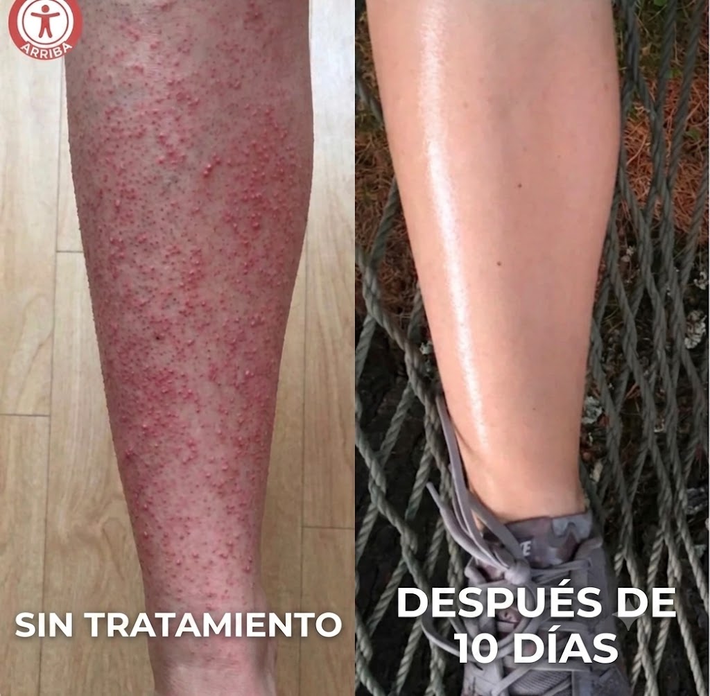 WhiteMoon® Strawberry Skin — KERA Crema Rejuvenecedora Triple Ácido